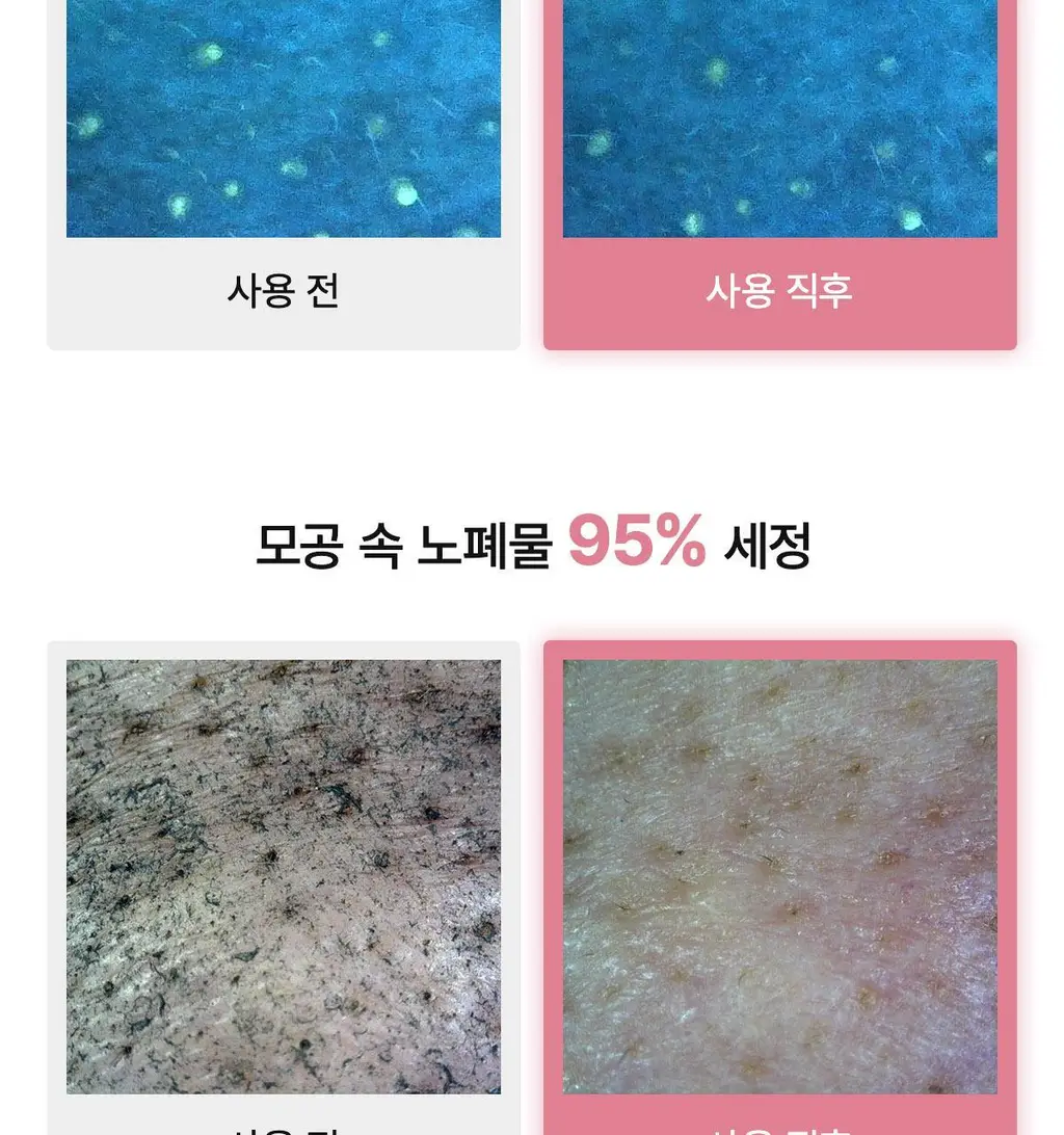 [탄탄모공/피지순삭] 바이오던스 콜라겐 클렌징 오일 200ml 단품/기획 상세페이지 17